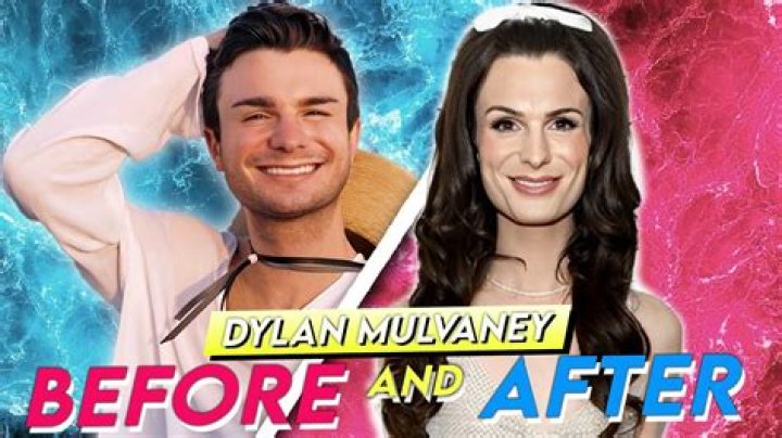 Dylan Mulvaney's Inspiring Transformation: Before And After