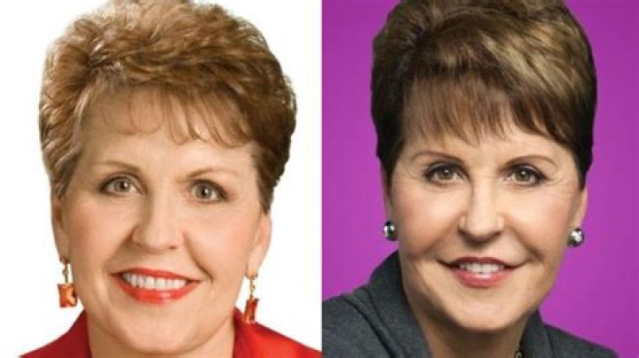 Joyce Meyer's Cosmetic Surgery: Uncovering The Truth