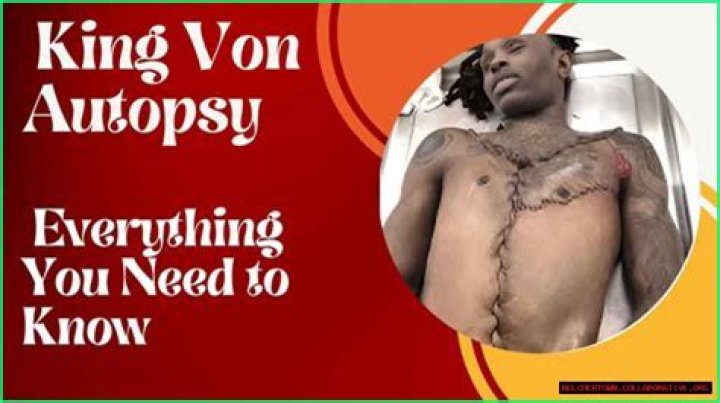 King Vons Autopsy Unlocks Secrets