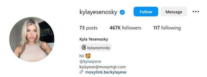 Kyla Yesenosky's Leaked Content And Its Implications