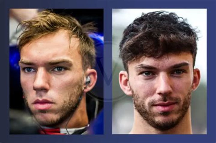 Unravel The Secrets Of Pierre Gasly's Hairline: Discoveries And Insights