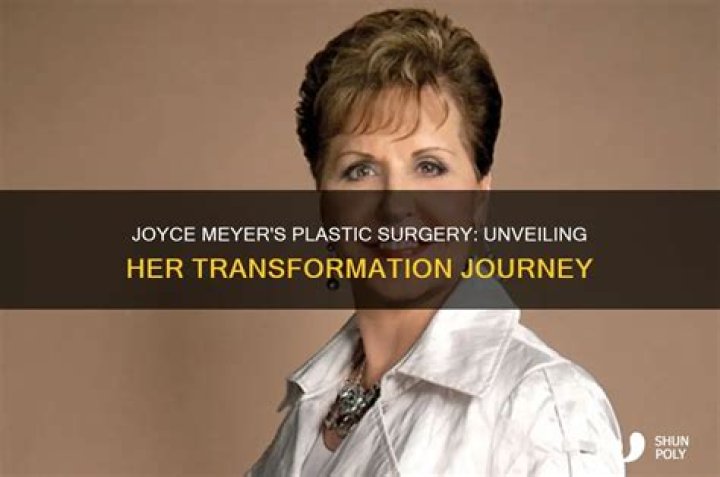 Unveiling Joyce Meyer's Transformation: Discoveries In Plastic Surgery
