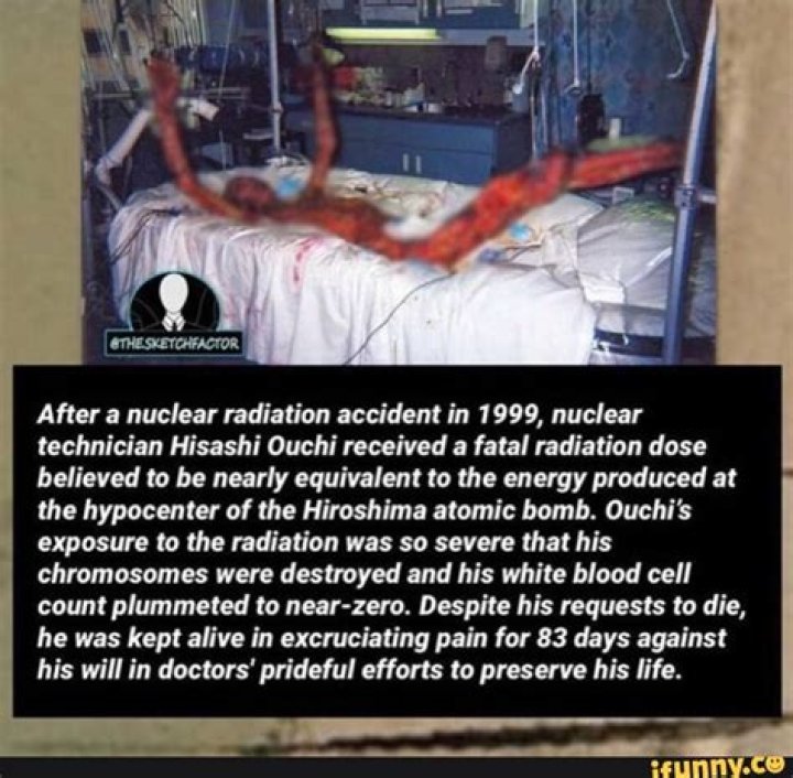 Unveiling The Horrors Of Radiation: The Mr. Ouchi Photo